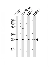 Anti-TIM-3 antibody used in Western Blot (WB). GTX04871