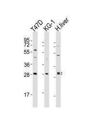 Anti-TIM-3 antibody used in Western Blot (WB). GTX04871
