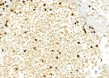 Anti-TIM-3 antibody used in IHC (Paraffin sections) (IHC-P). GTX04872