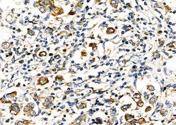 Anti-TIM-3 antibody used in IHC (Paraffin sections) (IHC-P). GTX04872