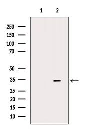 Anti-TIM-3 antibody used in Western Blot (WB). GTX04872