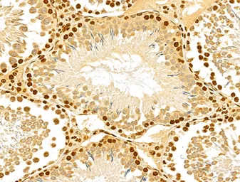 Anti-NUDT21 antibody used in IHC (Paraffin sections) (IHC-P). GTX04874