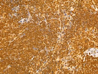 Anti-NUDT21 antibody used in IHC (Paraffin sections) (IHC-P). GTX04874