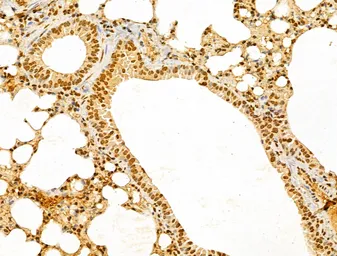 Anti-NUDT21 antibody used in IHC (Paraffin sections) (IHC-P). GTX04874