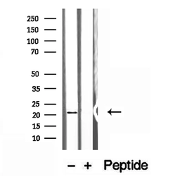 Anti-NUDT21 antibody used in Western Blot (WB). GTX04874