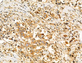 Anti-SLC22A8 antibody used in IHC (Paraffin sections) (IHC-P). GTX04875