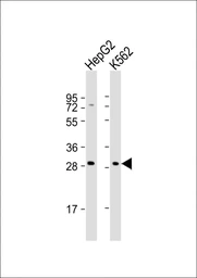 Anti-KLRC1 antibody used in Western Blot (WB). GTX04876