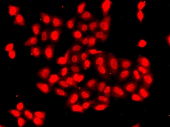 Anti-CaMKI delta antibody used in Immunocytochemistry/ Immunofluorescence (ICC/IF). GTX04878
