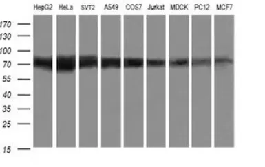 Anti-beta-Gal antibody [OTI10B2] used in Western Blot (WB). GTX04881