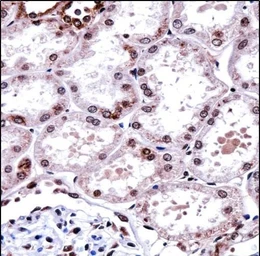 Anti-FOXD1 antibody used in IHC (Paraffin sections) (IHC-P). GTX04885