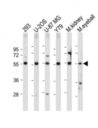 Anti-FOXD1 antibody used in Western Blot (WB). GTX04885