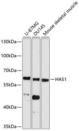 Anti-HAS1 antibody used in Western Blot (WB). GTX04887