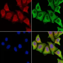 Anti-CTGF antibody used in Immunocytochemistry/ Immunofluorescence (ICC/IF). GTX04889