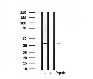 Anti-CTGF antibody used in Western Blot (WB). GTX04889
