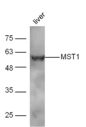 Anti-MST1 antibody used in Western Blot (WB). GTX04891