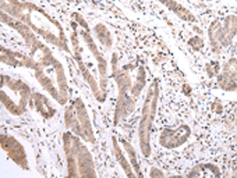 Anti-PCID2 antibody used in IHC (Paraffin sections) (IHC-P). GTX04896
