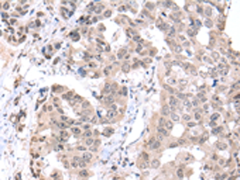Anti-PCID2 antibody used in IHC (Paraffin sections) (IHC-P). GTX04896