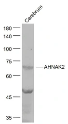 Anti-AHNAK2 antibody used in Western Blot (WB). GTX04899