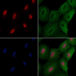 Anti-ELF4 antibody used in Immunocytochemistry/ Immunofluorescence (ICC/IF). GTX04903