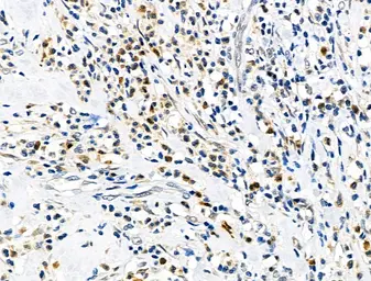 Anti-ELF4 antibody used in IHC (Paraffin sections) (IHC-P). GTX04903