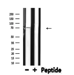 Anti-ELF4 antibody used in Western Blot (WB). GTX04903