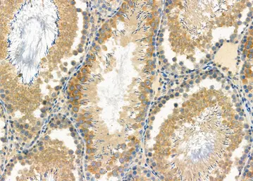 Anti-GAS2L1 antibody used in IHC (Paraffin sections) (IHC-P). GTX04905