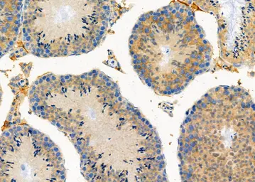 Anti-GAS2L1 antibody used in IHC (Paraffin sections) (IHC-P). GTX04905