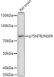 Anti-p75 NGF Receptor / CD271 antibody used in Western Blot (WB). GTX04906
