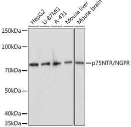 Anti-p75 NGF Receptor / CD271 antibody used in Western Blot (WB). GTX04906