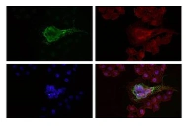 Anti-xCT / SLC7A11 antibody [ACGI-19] used in Immunocytochemistry/ Immunofluorescence (ICC/IF). GTX04907