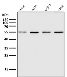 Anti-xCT / SLC7A11 antibody [ACGI-19] used in Western Blot (WB). GTX04907