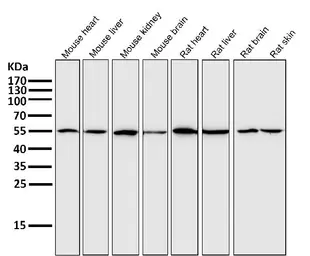Anti-xCT / SLC7A11 antibody [ACGI-19] used in Western Blot (WB). GTX04907