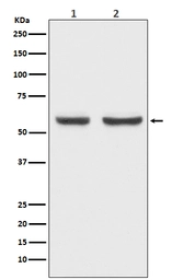 Anti-xCT / SLC7A11 antibody [ACGI-19] used in Western Blot (WB). GTX04907