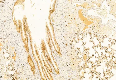 Anti-Caspase 3 antibody used in IHC (Paraffin sections) (IHC-P). GTX04908