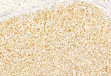 Anti-Caspase 3 antibody used in IHC (Paraffin sections) (IHC-P). GTX04908