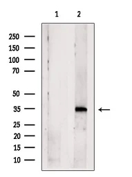Anti-Caspase 3 antibody used in Western Blot (WB). GTX04908