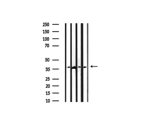 Anti-Caspase 3 antibody used in Western Blot (WB). GTX04908