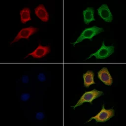 Anti-Tyrosinase antibody used in Immunocytochemistry/ Immunofluorescence (ICC/IF). GTX04909