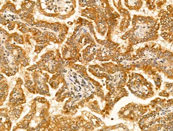 Anti-Tyrosinase antibody used in IHC (Paraffin sections) (IHC-P). GTX04909