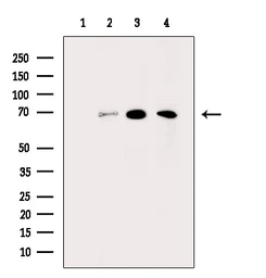 Anti-Tyrosinase antibody used in Western Blot (WB). GTX04909