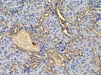 Anti-TRP1 antibody used in IHC (Paraffin sections) (IHC-P). GTX04910