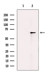 Anti-TRP1 antibody used in Western Blot (WB). GTX04910