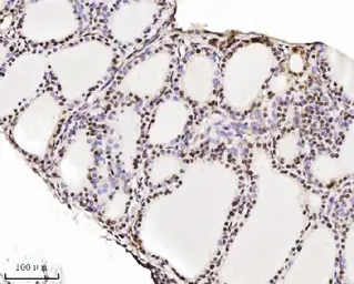 Anti-TIF1 alpha antibody [4G6C2] used in IHC (Paraffin sections) (IHC-P). GTX04912