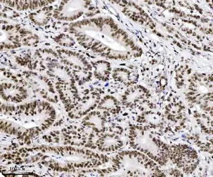 Anti-TIF1 alpha antibody [4G6C2] used in IHC (Paraffin sections) (IHC-P). GTX04912