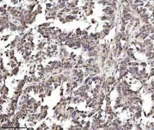 Anti-TIF1 alpha antibody [4G6C2] used in IHC (Paraffin sections) (IHC-P). GTX04912