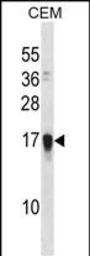 Anti-NDSP antibody used in Western Blot (WB). GTX04923