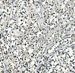 Anti-ATP5H antibody [6B12] used in IHC (Paraffin sections) (IHC-P). GTX04924