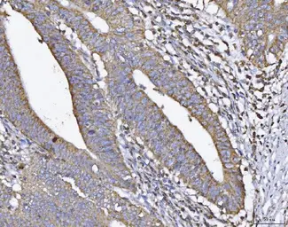 Anti-ATP5H antibody used in IHC (Paraffin sections) (IHC-P). GTX04925