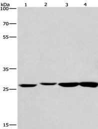 Anti-KLF7 antibody used in Western Blot (WB). GTX04926