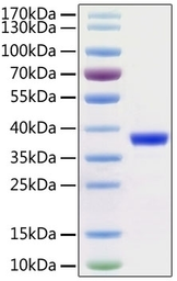SARS-CoV-2 (COVID-19) 3CL protease protein. GTX04930-pro